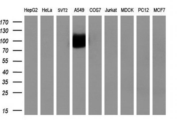 NTRK3 Antibody in Western Blot (WB)