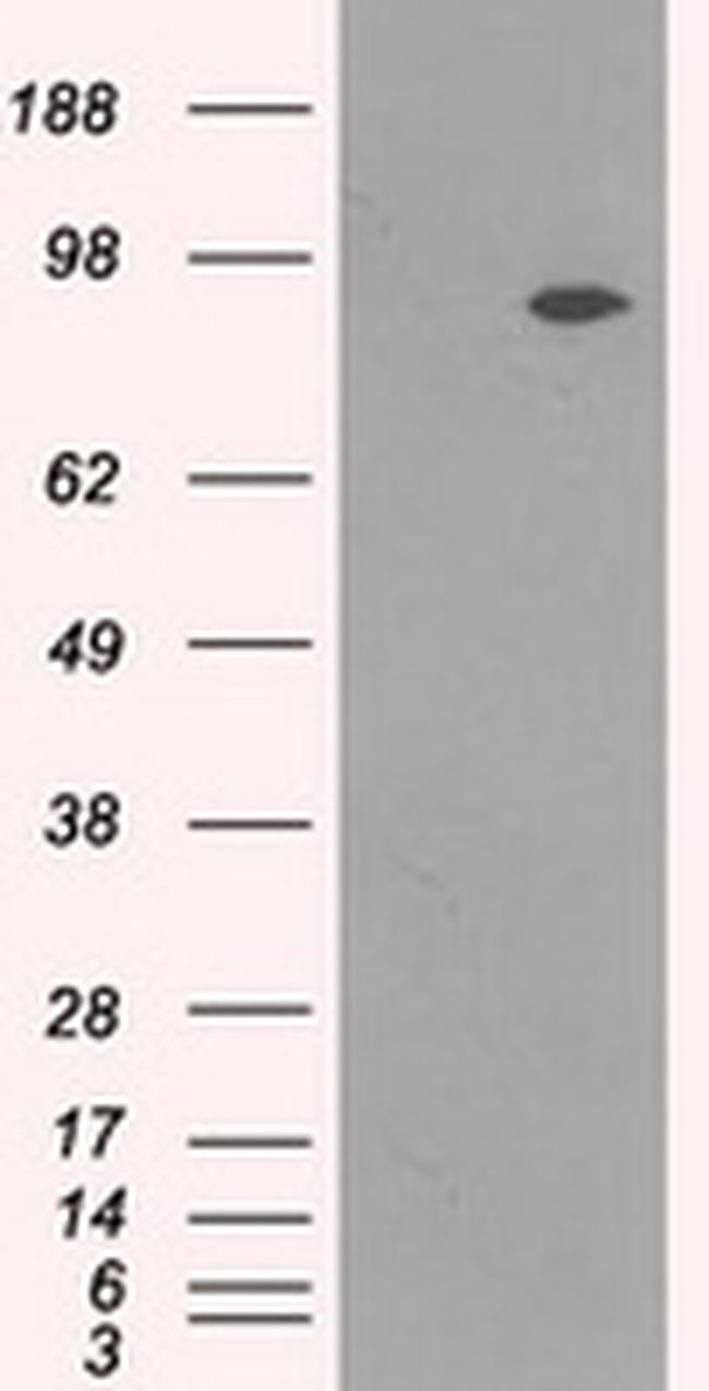 NTRK3 Antibody in Western Blot (WB)