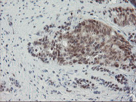 NUB1 Antibody in Immunohistochemistry (Paraffin) (IHC (P))