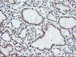 NUB1 Antibody in Immunohistochemistry (Paraffin) (IHC (P))