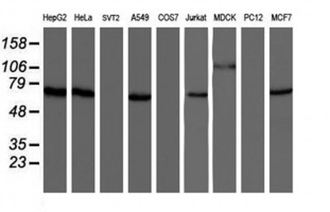 NUB1 Antibody in Western Blot (WB)