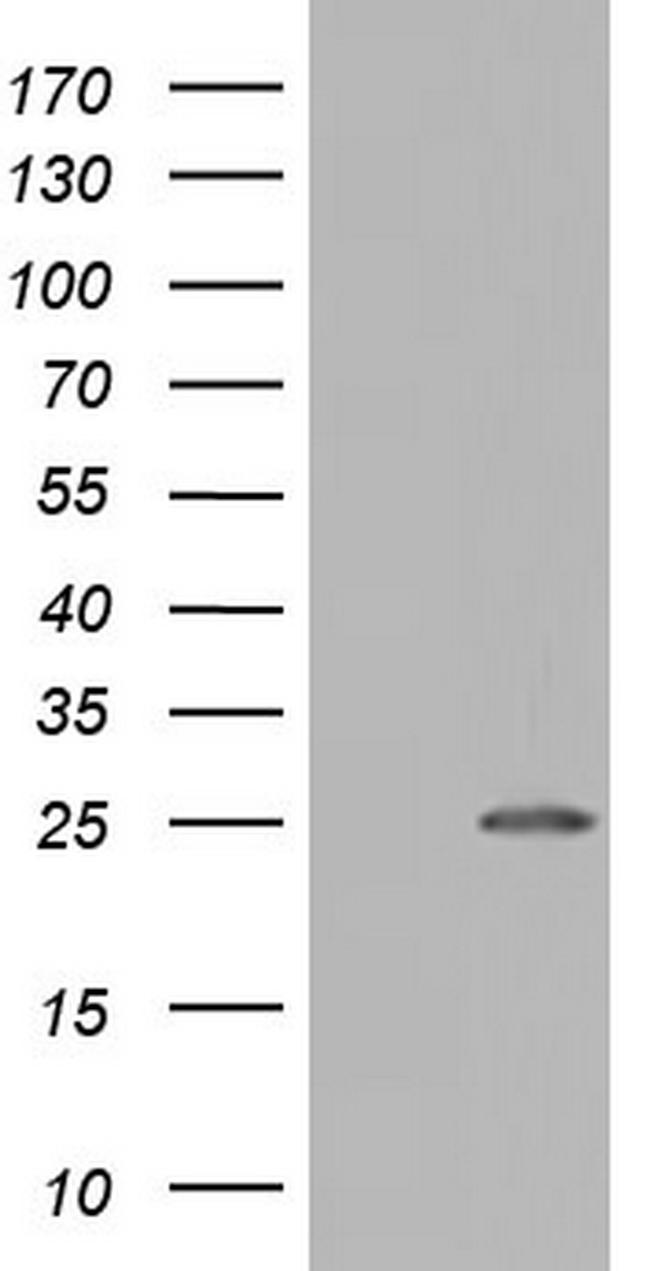 NUDT10 Antibody in Western Blot (WB)