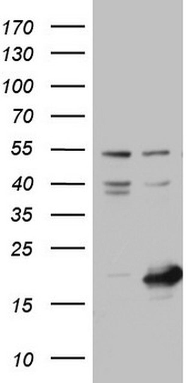 NUDT10 Antibody in Western Blot (WB)