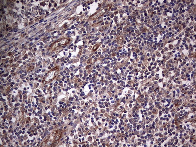 NUDT12 Antibody in Immunohistochemistry (Paraffin) (IHC (P))