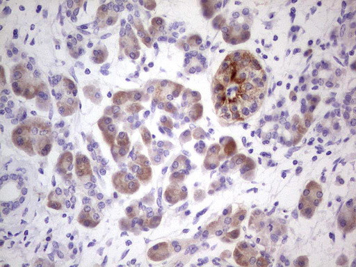 NUDT12 Antibody in Immunohistochemistry (Paraffin) (IHC (P))