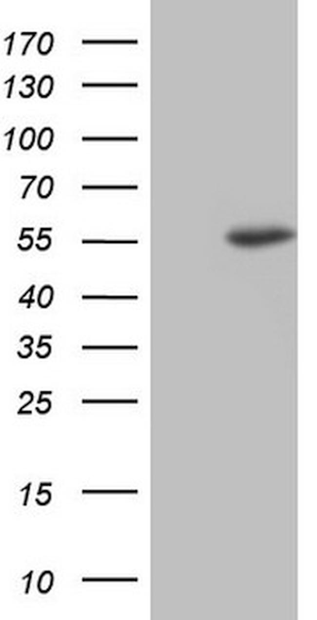 NUDT12 Antibody in Western Blot (WB)