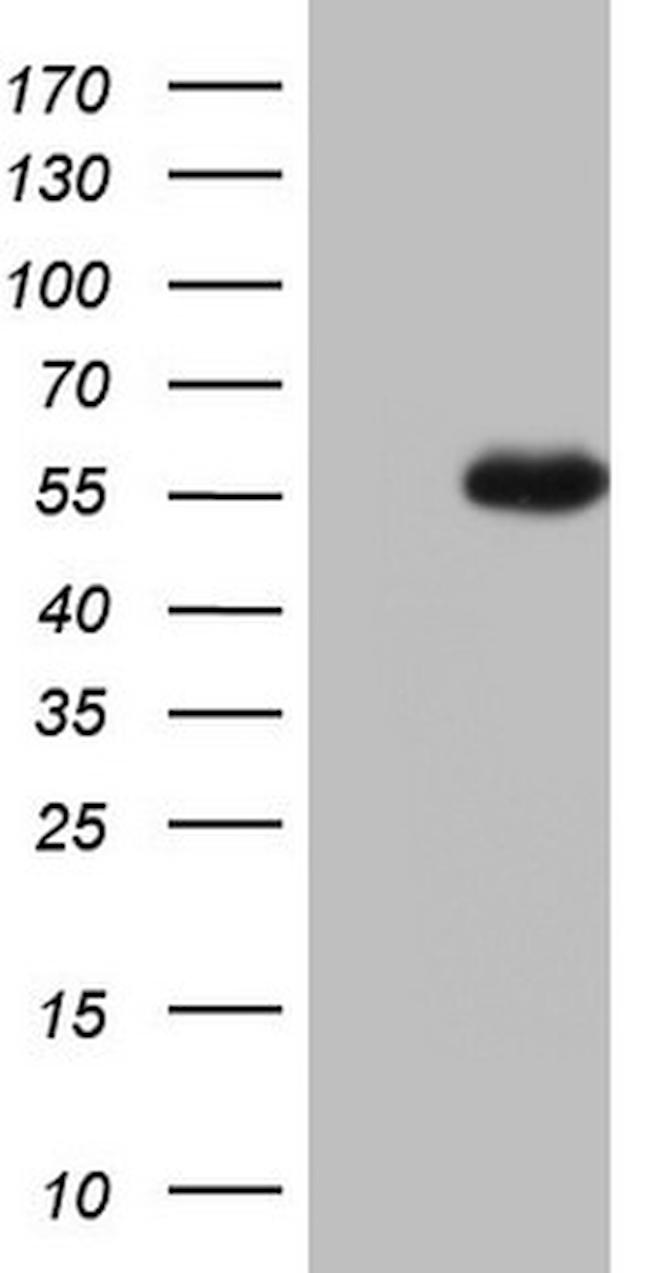 NUDT12 Antibody in Western Blot (WB)