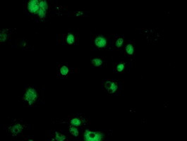 NUDT18 Antibody in Immunocytochemistry (ICC/IF)