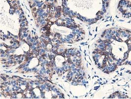 NUDT18 Antibody in Immunohistochemistry (Paraffin) (IHC (P))