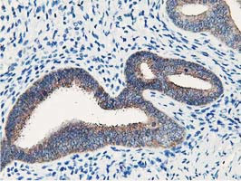 NUDT18 Antibody in Immunohistochemistry (Paraffin) (IHC (P))