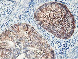 NUDT18 Antibody in Immunohistochemistry (Paraffin) (IHC (P))