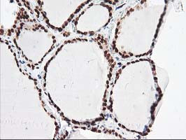 NUDT18 Antibody in Immunohistochemistry (Paraffin) (IHC (P))