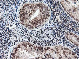 NUDT18 Antibody in Immunohistochemistry (Paraffin) (IHC (P))