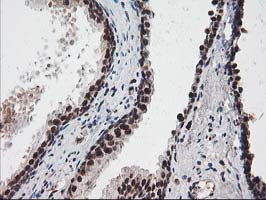 NUDT18 Antibody in Immunohistochemistry (Paraffin) (IHC (P))