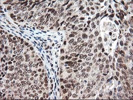 NUDT18 Antibody in Immunohistochemistry (Paraffin) (IHC (P))