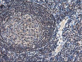 NUDT18 Antibody in Immunohistochemistry (Paraffin) (IHC (P))