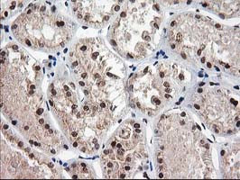 NUDT18 Antibody in Immunohistochemistry (Paraffin) (IHC (P))