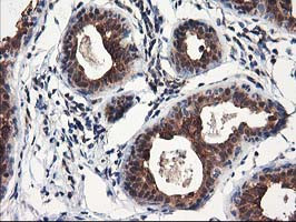 NUDT18 Antibody in Immunohistochemistry (Paraffin) (IHC (P))