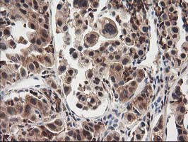 NUDT18 Antibody in Immunohistochemistry (Paraffin) (IHC (P))