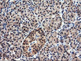 NUDT18 Antibody in Immunohistochemistry (Paraffin) (IHC (P))