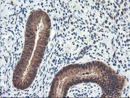 NUDT18 Antibody in Immunohistochemistry (Paraffin) (IHC (P))