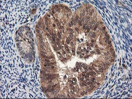 NUDT18 Antibody in Immunohistochemistry (Paraffin) (IHC (P))