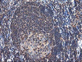 NUDT18 Antibody in Immunohistochemistry (Paraffin) (IHC (P))