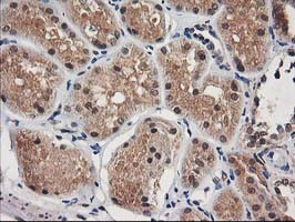 NUDT18 Antibody in Immunohistochemistry (Paraffin) (IHC (P))