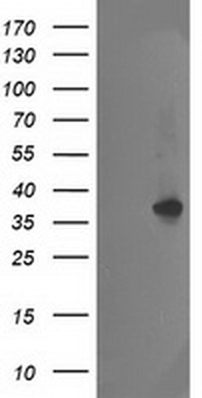 NUDT18 Antibody in Western Blot (WB)