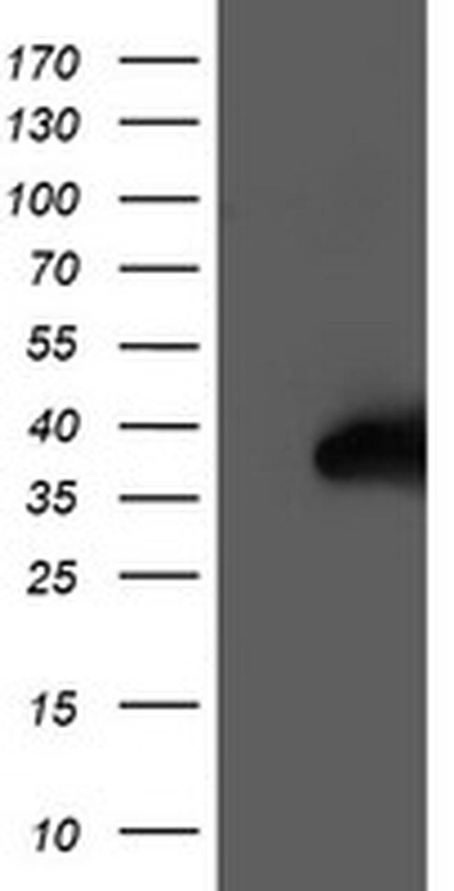 NUDT18 Antibody in Western Blot (WB)