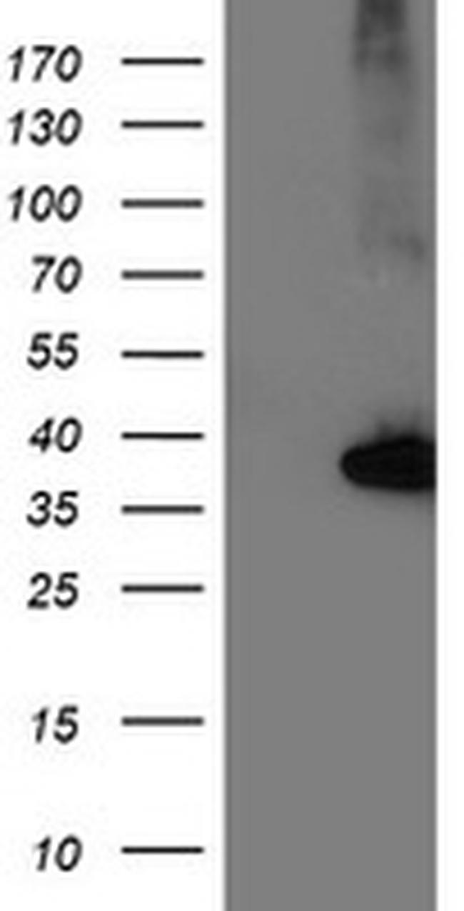 NUDT18 Antibody in Western Blot (WB)