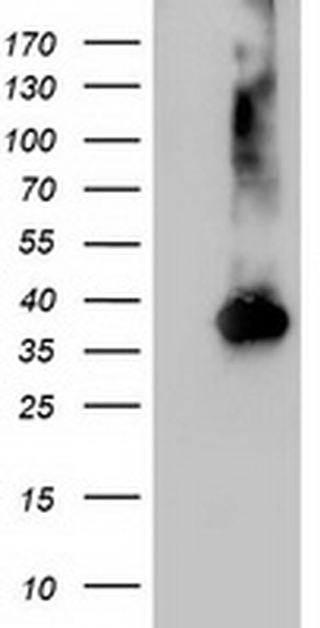 NUDT18 Antibody in Western Blot (WB)