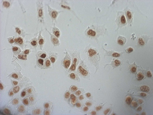 NUDT21 Antibody in Immunocytochemistry (ICC/IF)