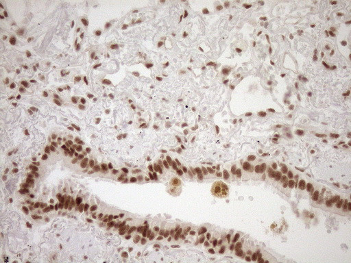 NUDT21 Antibody in Immunohistochemistry (Paraffin) (IHC (P))