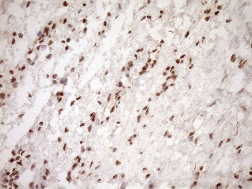 NUDT21 Antibody in Immunohistochemistry (Paraffin) (IHC (P))