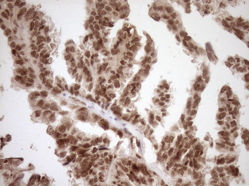 NUDT21 Antibody in Immunohistochemistry (Paraffin) (IHC (P))