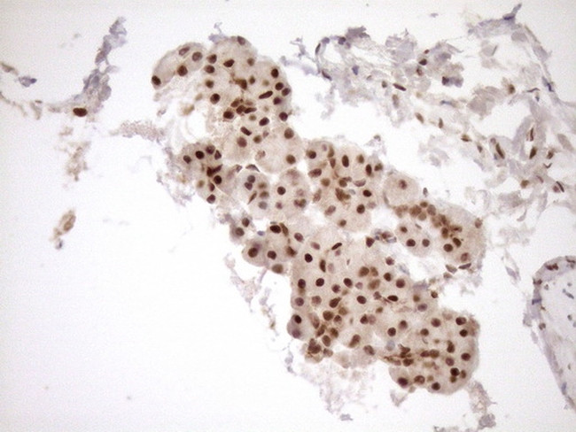 NUDT21 Antibody in Immunohistochemistry (Paraffin) (IHC (P))