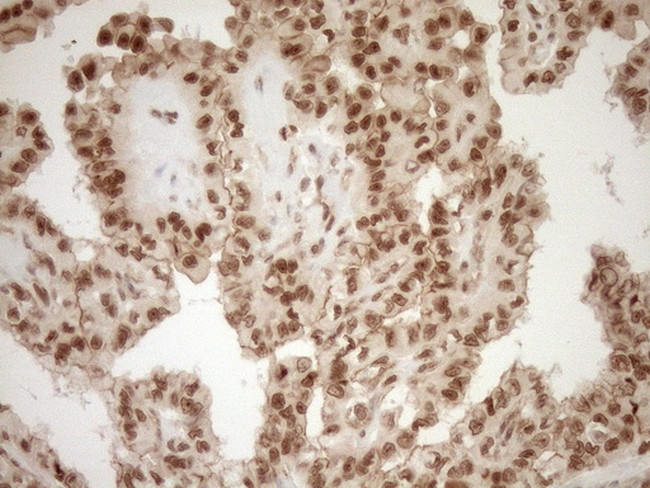 NUDT21 Antibody in Immunohistochemistry (Paraffin) (IHC (P))