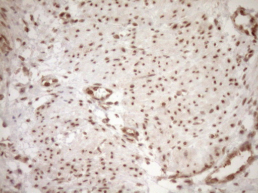 NUDT21 Antibody in Immunohistochemistry (Paraffin) (IHC (P))