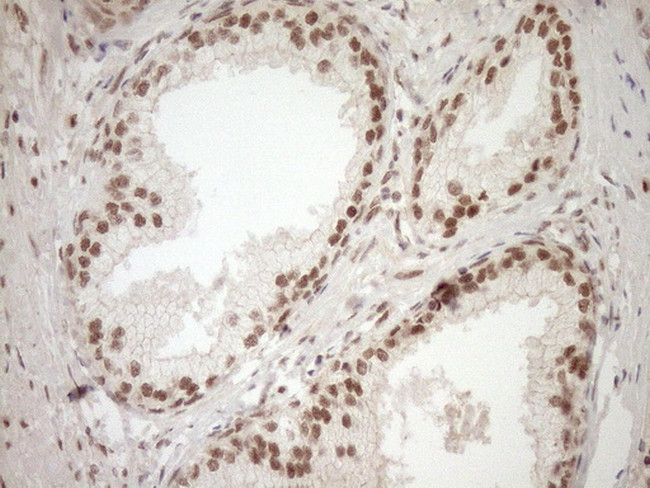 NUDT21 Antibody in Immunohistochemistry (Paraffin) (IHC (P))