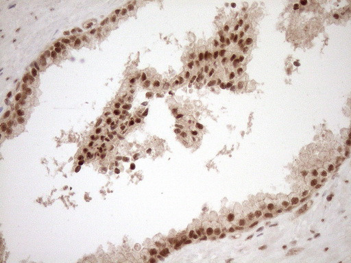 NUDT21 Antibody in Immunohistochemistry (Paraffin) (IHC (P))