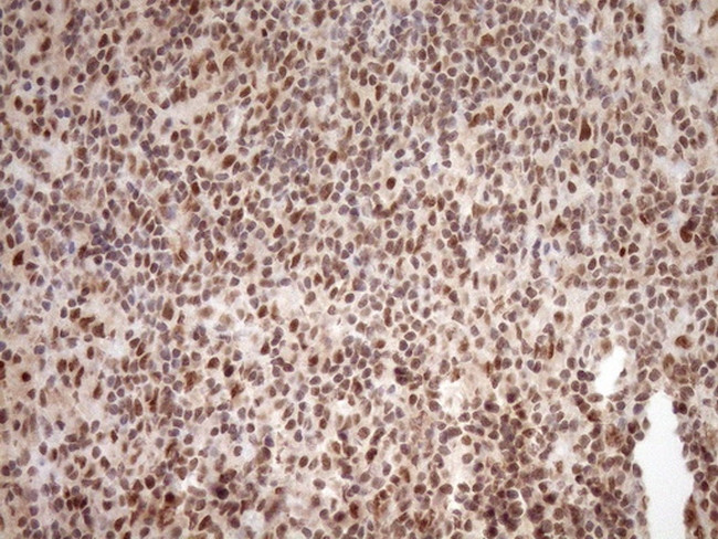 NUDT21 Antibody in Immunohistochemistry (Paraffin) (IHC (P))