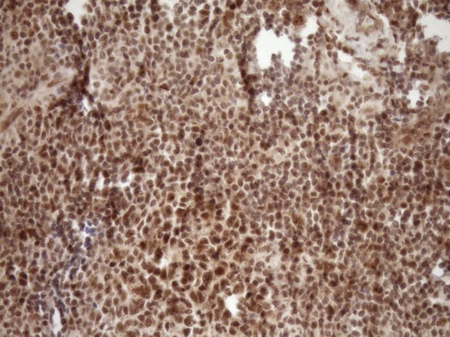 NUDT21 Antibody in Immunohistochemistry (Paraffin) (IHC (P))