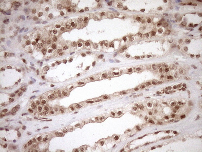 NUDT21 Antibody in Immunohistochemistry (Paraffin) (IHC (P))