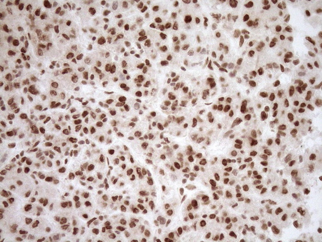 NUDT21 Antibody in Immunohistochemistry (Paraffin) (IHC (P))