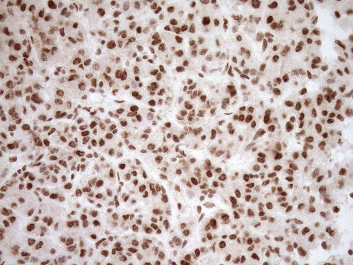 NUDT21 Antibody in Immunohistochemistry (Paraffin) (IHC (P))