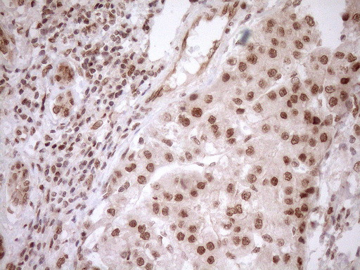 NUDT21 Antibody in Immunohistochemistry (Paraffin) (IHC (P))