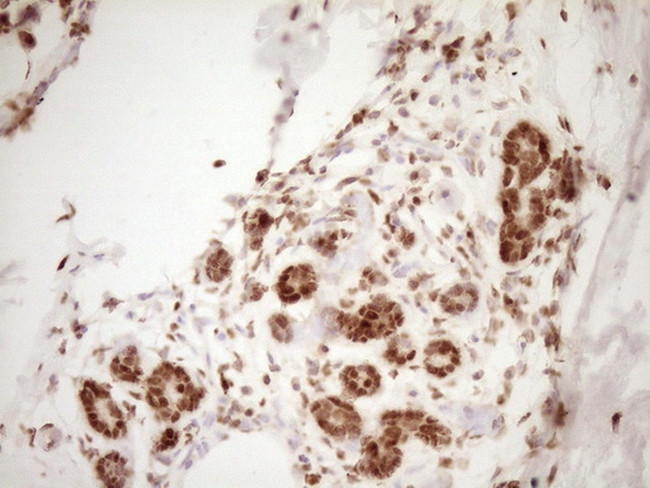 NUDT21 Antibody in Immunohistochemistry (Paraffin) (IHC (P))