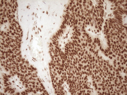 NUDT21 Antibody in Immunohistochemistry (Paraffin) (IHC (P))