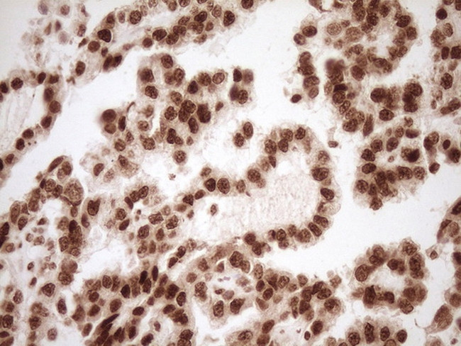 NUDT21 Antibody in Immunohistochemistry (Paraffin) (IHC (P))